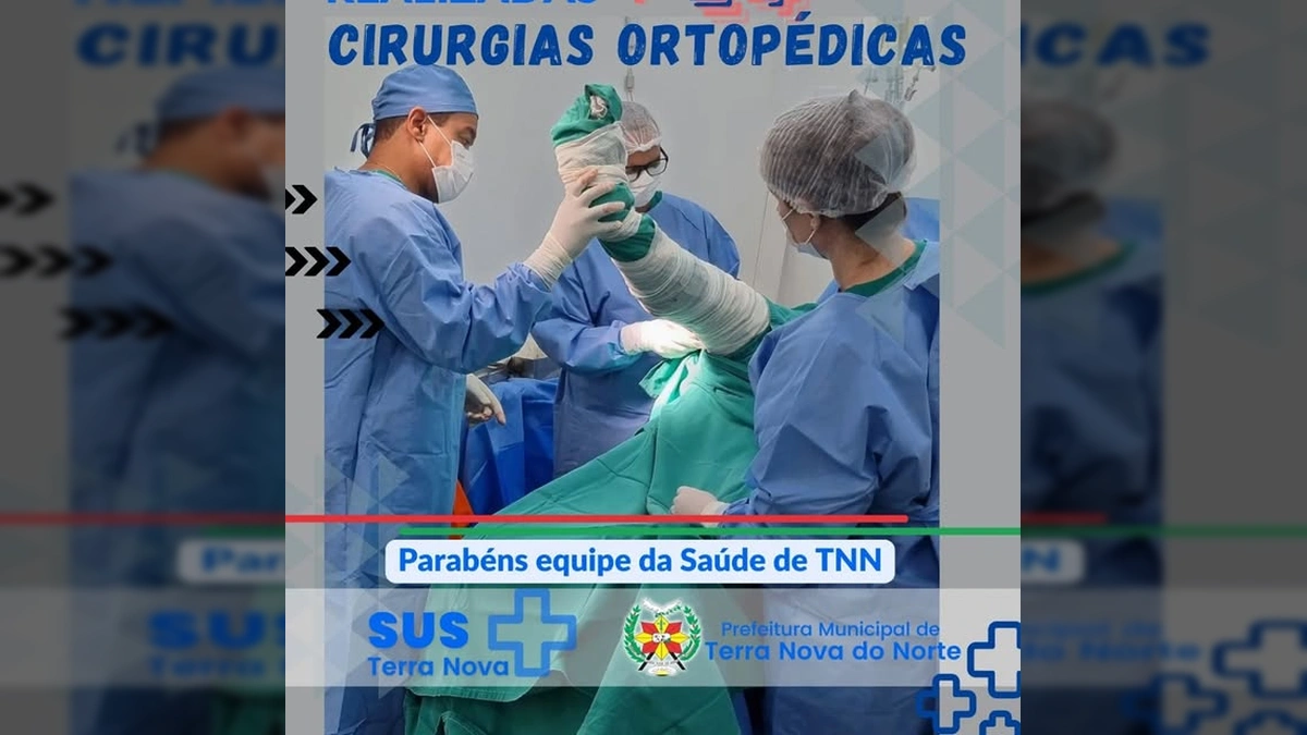 Profissionais de saúde em Terra Nova do Norte realizando uma cirurgia ortopédica em sala de operações. Crédito: Prefeitura Municipal de Terra Nova do Norte / Instagram